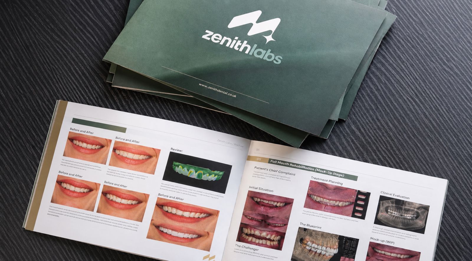 Finding a Dental Lab in the UK: What Really Matters Beyond Proximity
