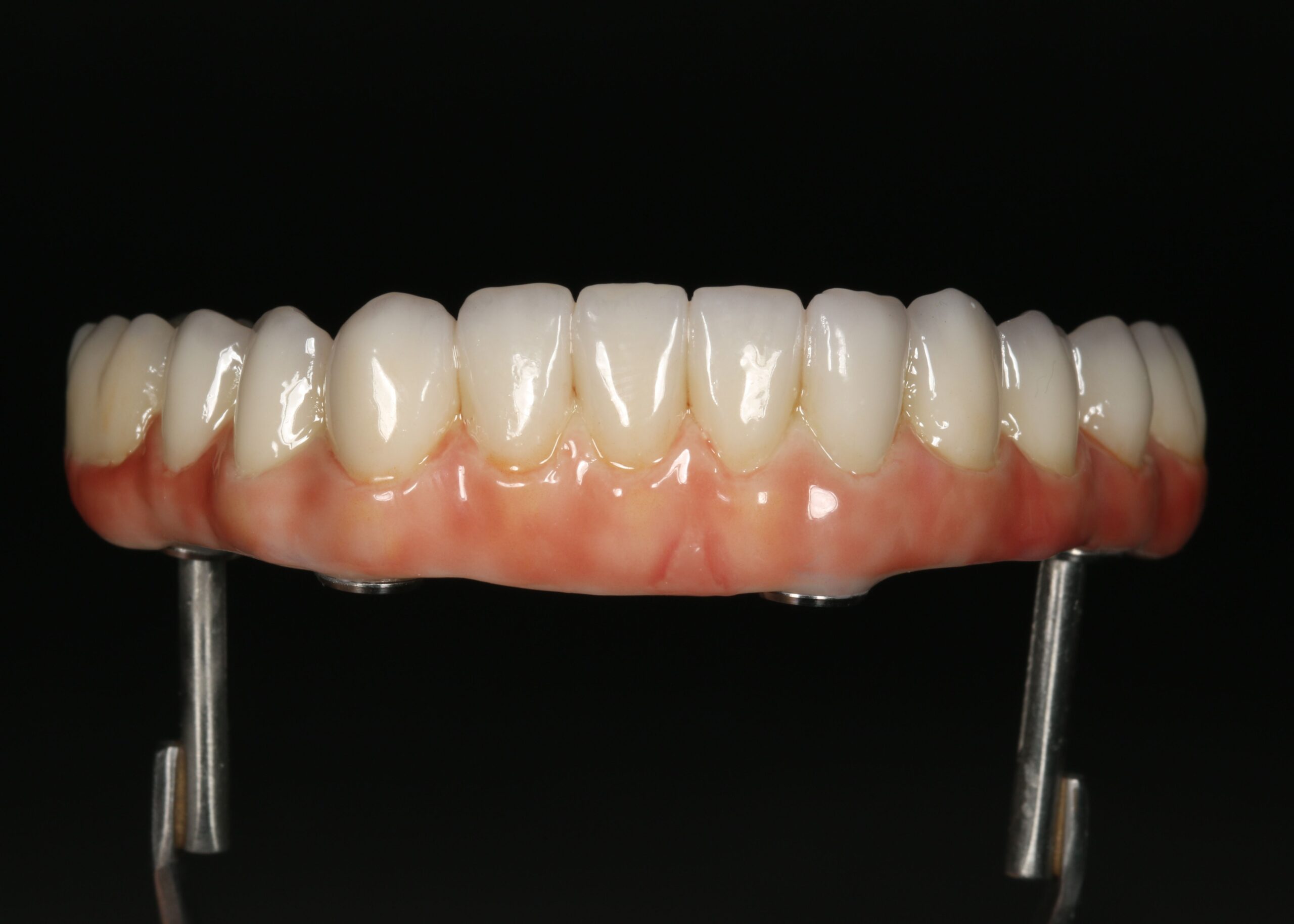 Full-arch implant-supported prosthesis with pink gingival restoration material, displayed on implant analogs against a black background.