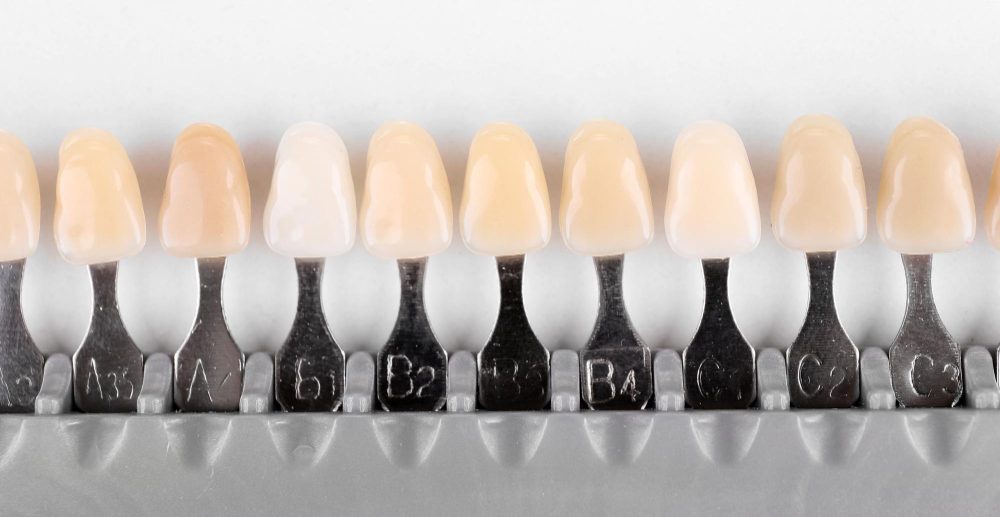 Digital Shade Matching: Communicating Colour Accurately to Your Lab