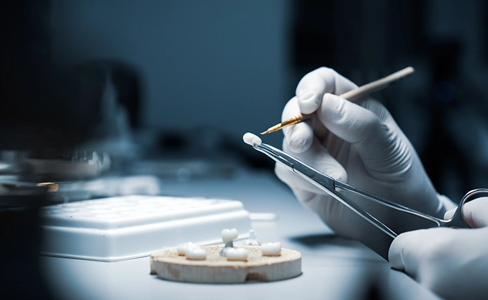 Dental technician using tweezers and a fine brush to hand-finish a ceramic crown beside a dental model with tooth copings