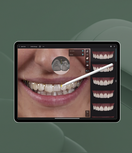 Intraoral Scanners: What Matters for the Lab and How to Send a Scan That Fits